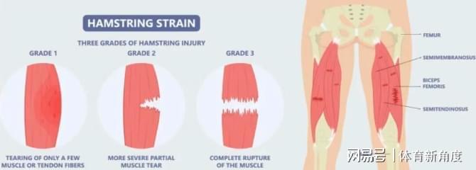  东契奇欧洲治伤背后：干细胞技术成胜负手，湖人医疗体系遭信任危机 体育新闻